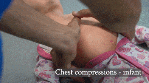 QR4-PLS_Chest_Compressions_2thumbs (gif)